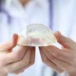 Breast Implant Surgery