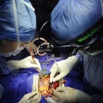 Open Heart Surgery