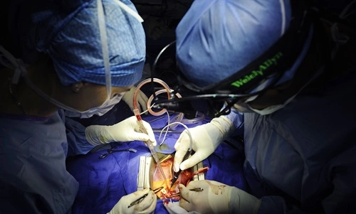 Open Heart Surgery