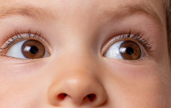 Child Cataract Surgery