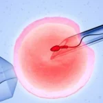 IVF