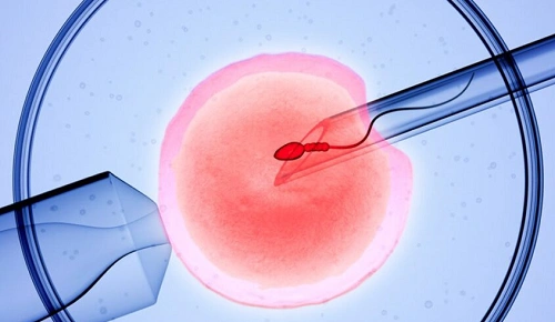 IVF