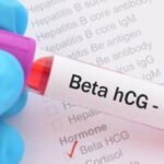 Beta hCG Test