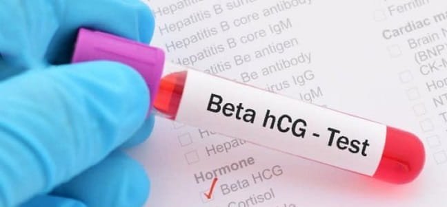 Beta hCG Test